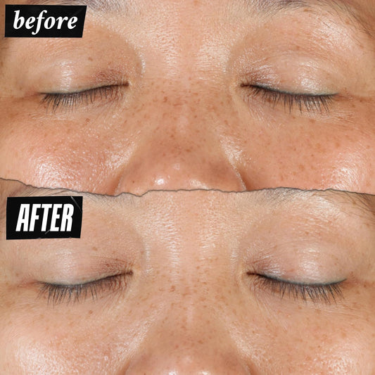 Kiehl's Clearly Corrective Dark Spot Serum – Brightening & Hyperpigmentation Treatment