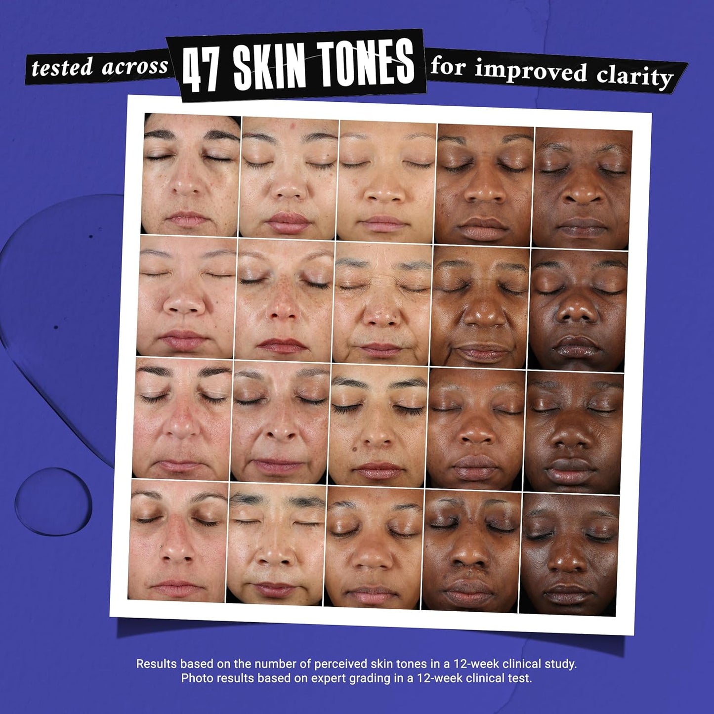 Kiehl's Clearly Corrective Dark Spot Serum – Brightening & Hyperpigmentation Treatment