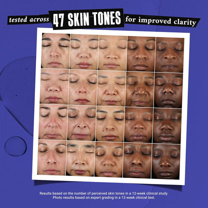 Kiehl's Clearly Corrective Dark Spot Serum – Brightening & Hyperpigmentation Treatment