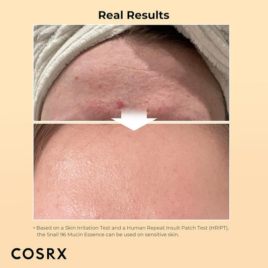 COSRX Snail Mucin 96% Power Repairing Essence - Hydrating Serum for Dull Skin & Fine Lines - GREEN MART LAND