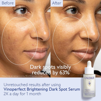 Dark Spot Brightening Serum Vitamin C Alternative 30ML - GREEN MART LAND