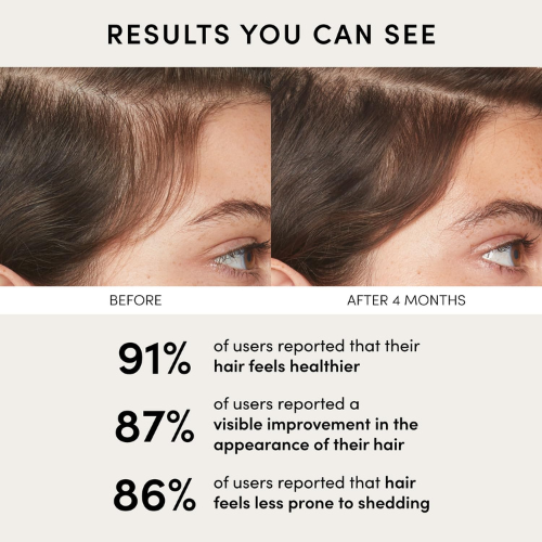 OUAI Scalp Serum with Red Clover Extract & Peptides – 2 fl oz