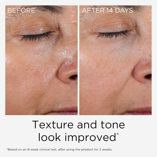 Elizabeth Arden Prevage Anti-Aging Face Serum 2.0 | Brightening & Dark Spot Corrector for Women