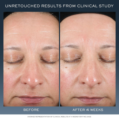 Lancôme Advanced Génifique Night Cream | Repairs & Strengthens Skin Barrier Overnight | 1.7 fl. oz