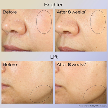 Shiseido Vital Perfection Uplifting & Firming Cream – Anti-Aging Moisturizer for Normal to Dry Skin | 50 ml