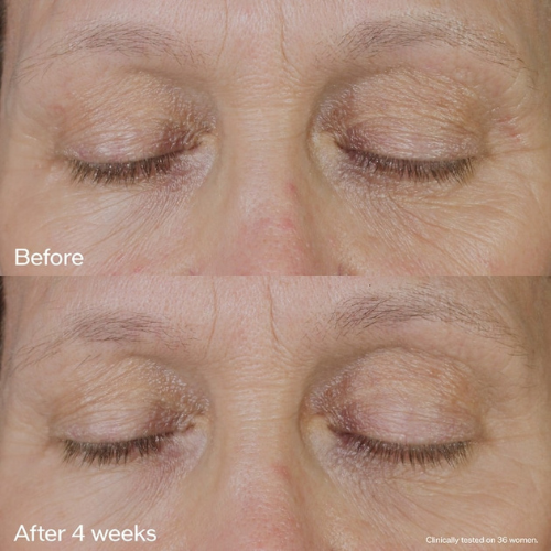 Shiseido Vital Perfection Uplifting & Firming Eye Cream | Anti-Aging Treatment – 15 ml / 0.52 oz